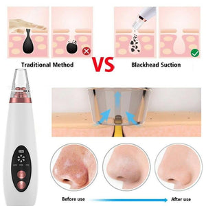 Blackhead Vacuum Cleaner